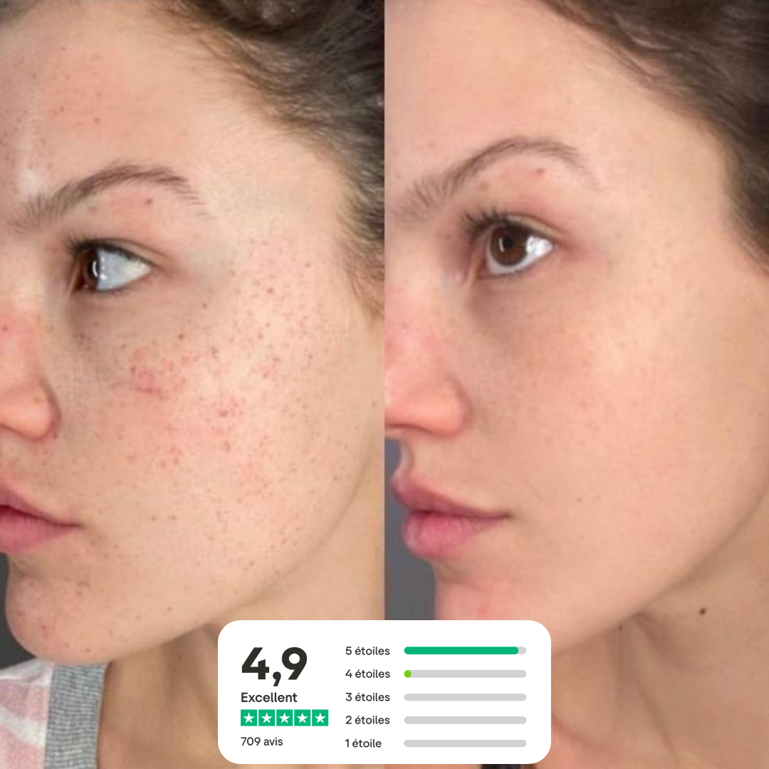 Savon au lait de chèvre - Anti-imperfections naturel