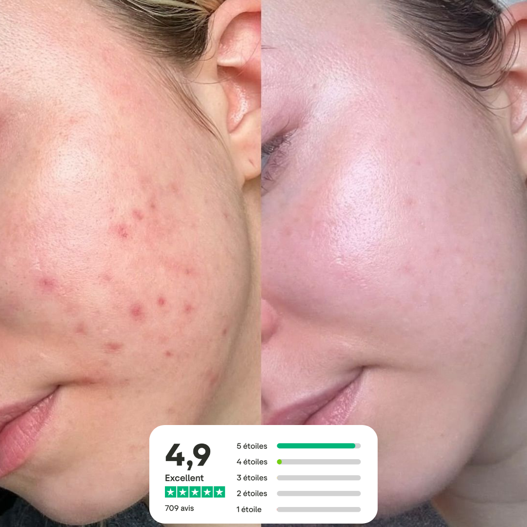 Savon au lait de chèvre - Anti-imperfections naturel