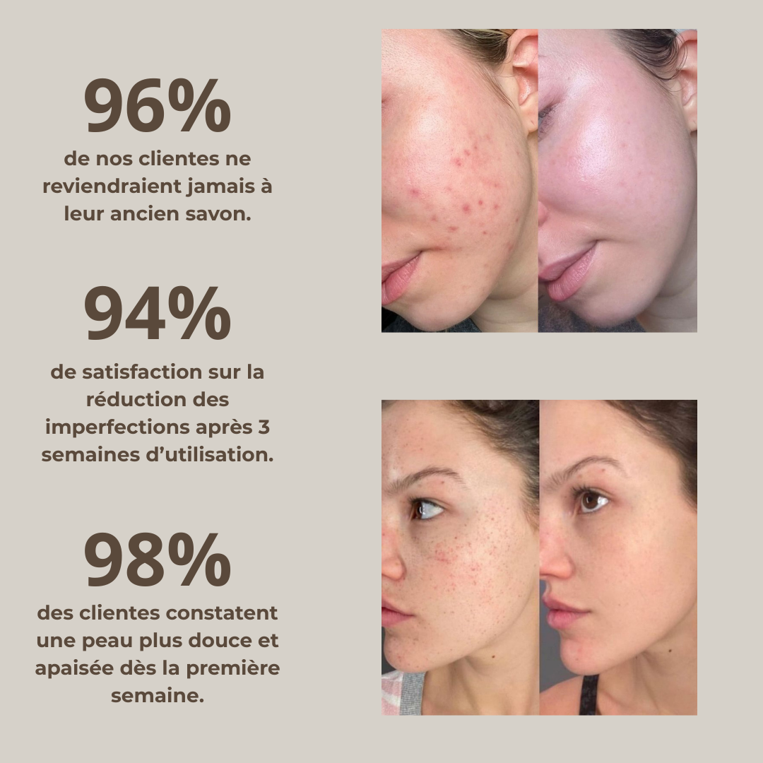 Savon au lait de chèvre  Peaux sensibles & à imperfections