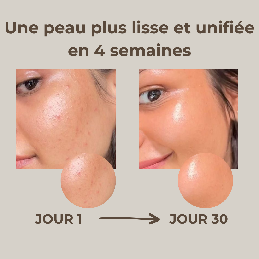 Savon au lait de chèvre  Peaux sensibles & à imperfections