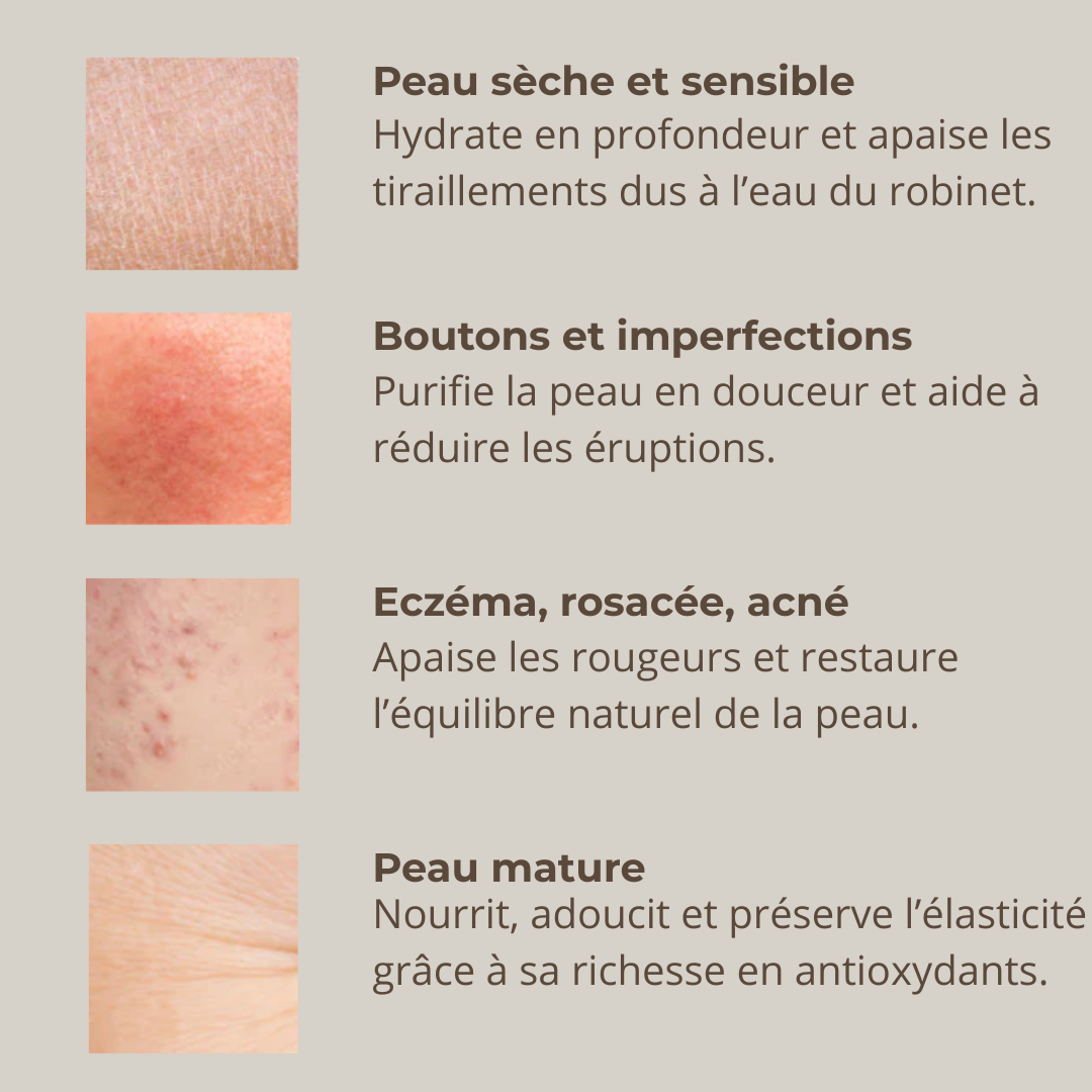 Savon au lait de chèvre  Peaux sensibles & à imperfections