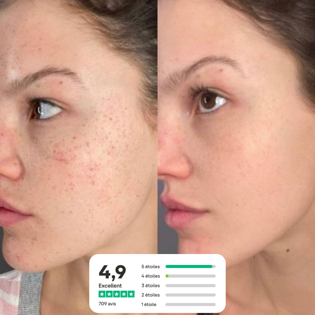 Savon au lait de chèvre  Peaux sensibles & à imperfections