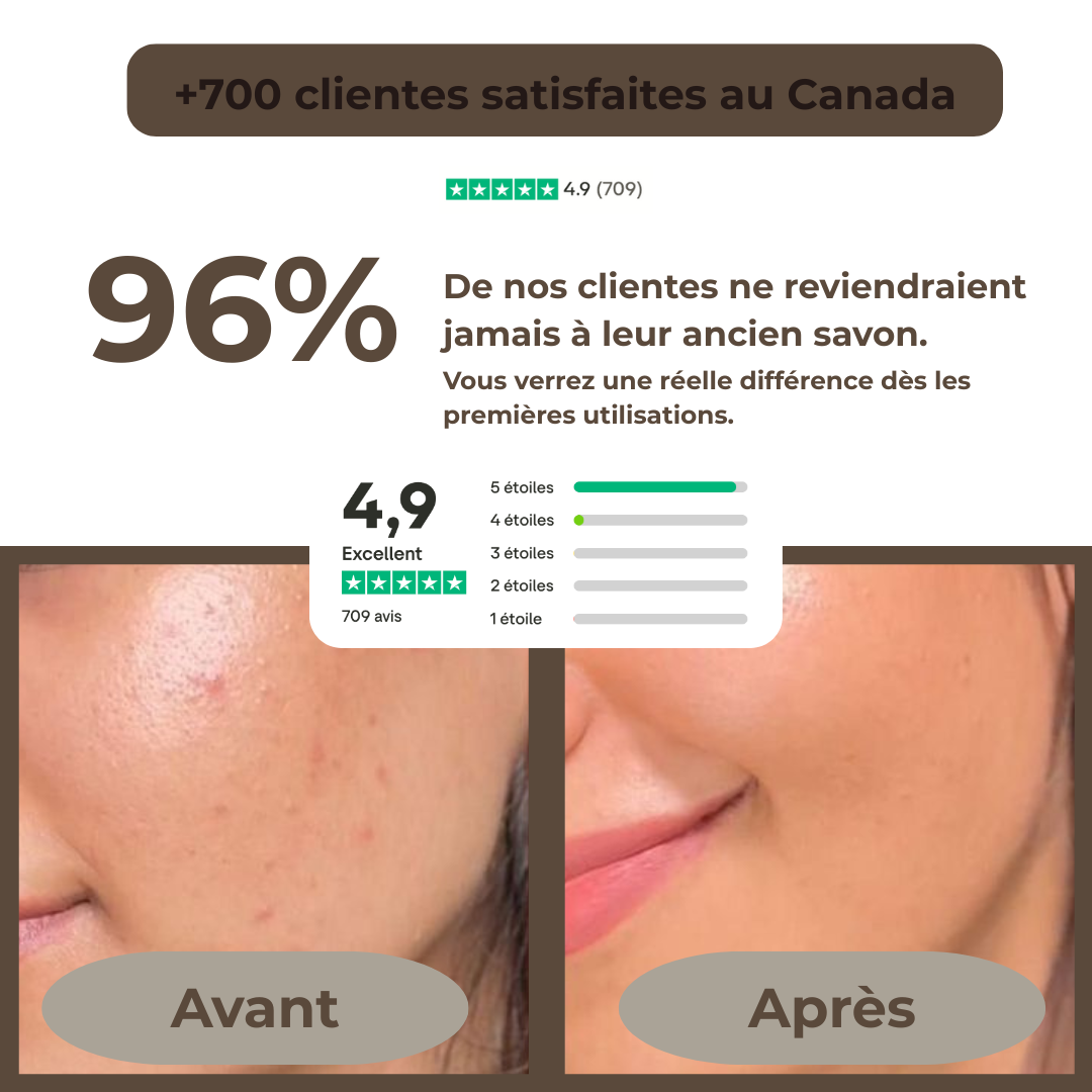 Savon au lait de chèvre - Anti-imperfections naturel